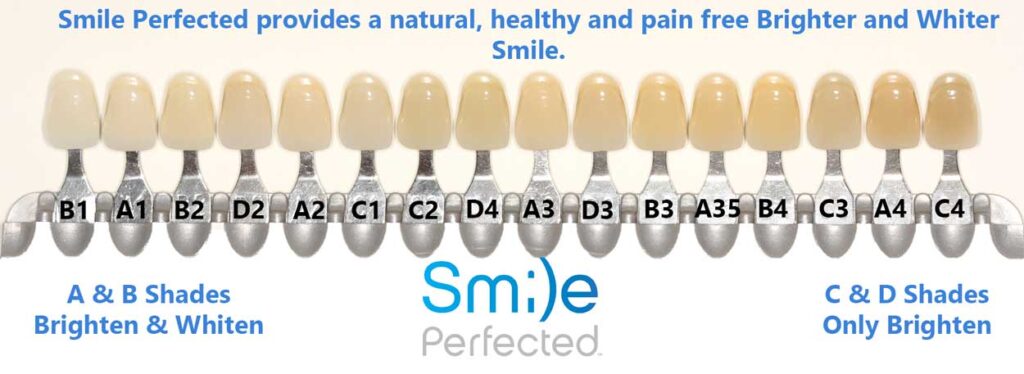 Smile Perfected Shade Guide