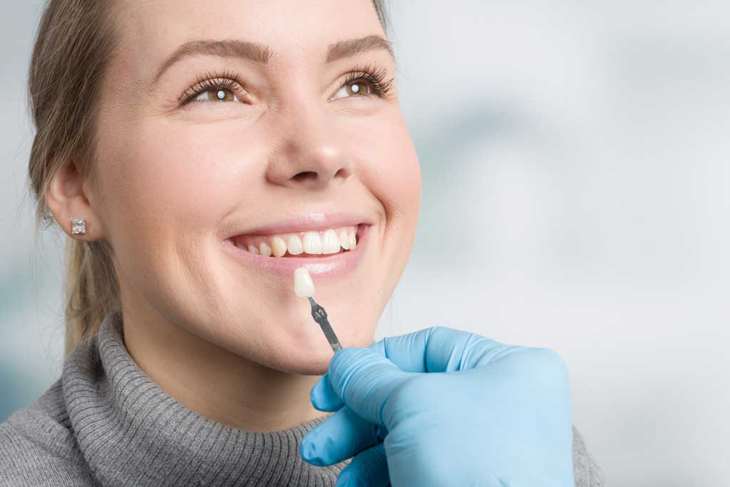 How to Whiten Teeth Before Getting Dental Implants and Crowns