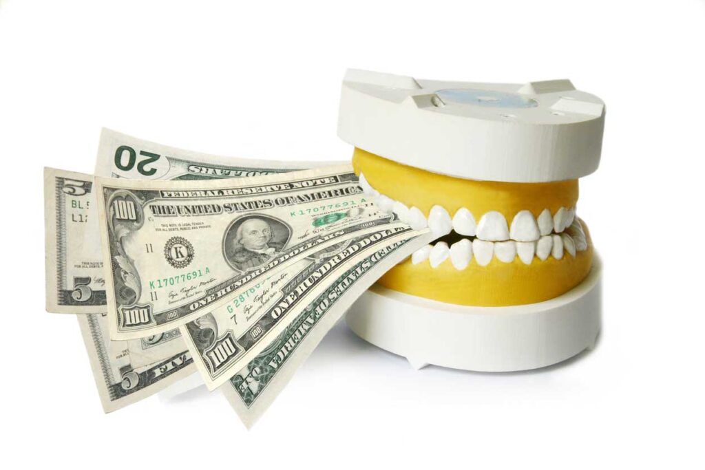In office whitening for dentist - cost