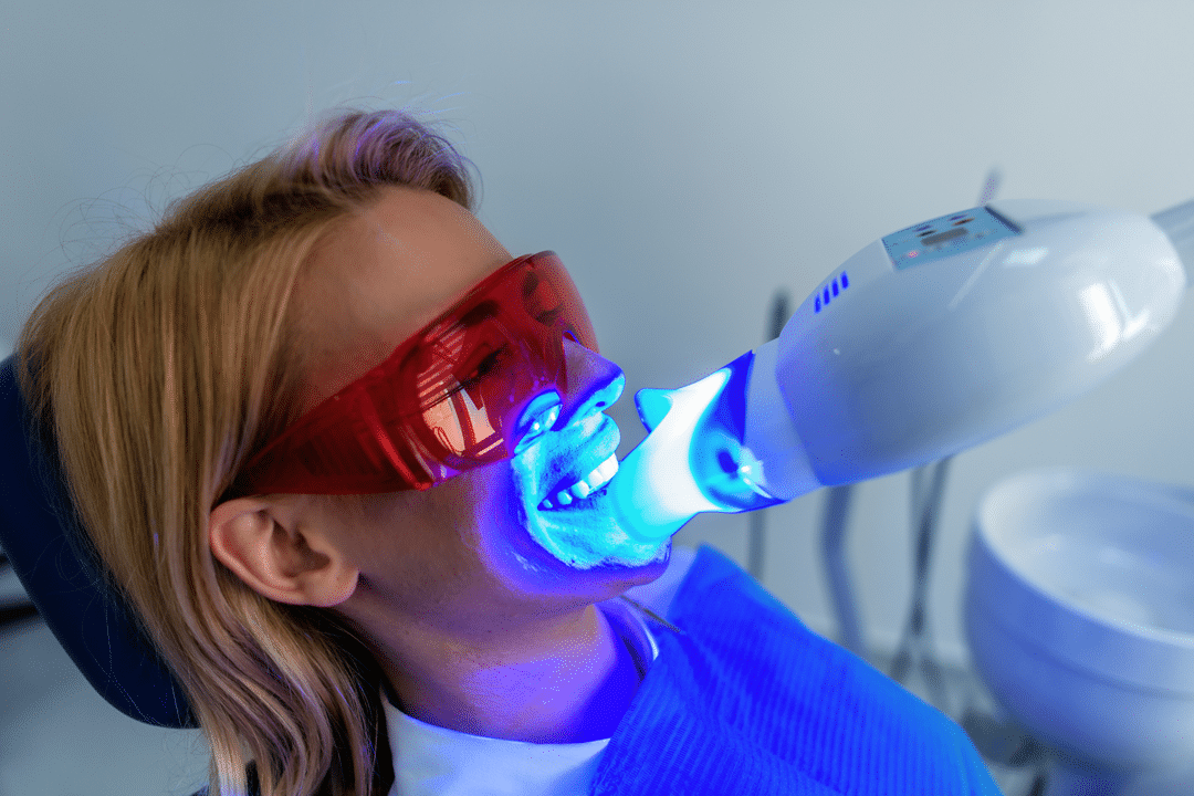 smile-perfected-light-heats-gel