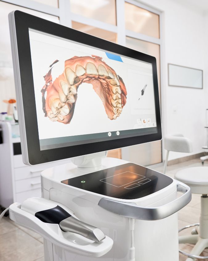 Top Intraoral Scanners Cost Top Intraoral Scanners Cost