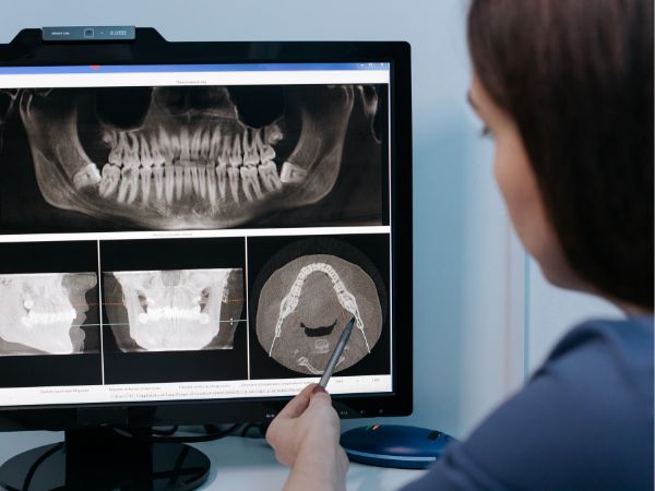 When to Invest in an X-Ray Machine?